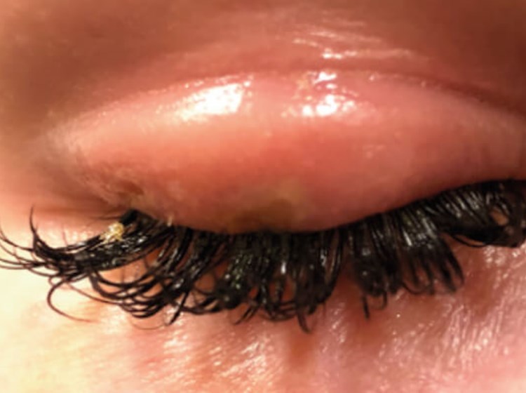 How to Restore Eyelash Glue 
