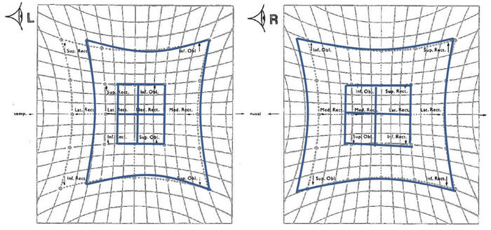 Hess Chart Ophthalmology