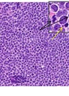 Pathology quiz - immunohistochemical stains
