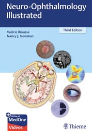 Neuro-Ophthalmology Illustrated book cover