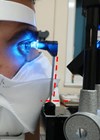 Photograph of a patient having his IOP checked with the Goldmann applanation tonometry technique.
