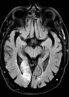 Photo showing MRI head
