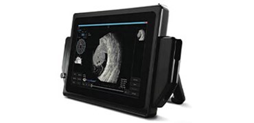 Sonomed Escalon VuPad Ultrasound