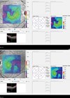 Images of retinal thickness maps.