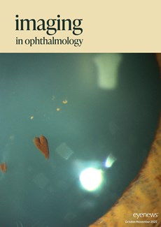 Imaging Issue I