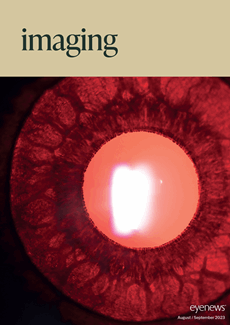 Imaging Issue II
