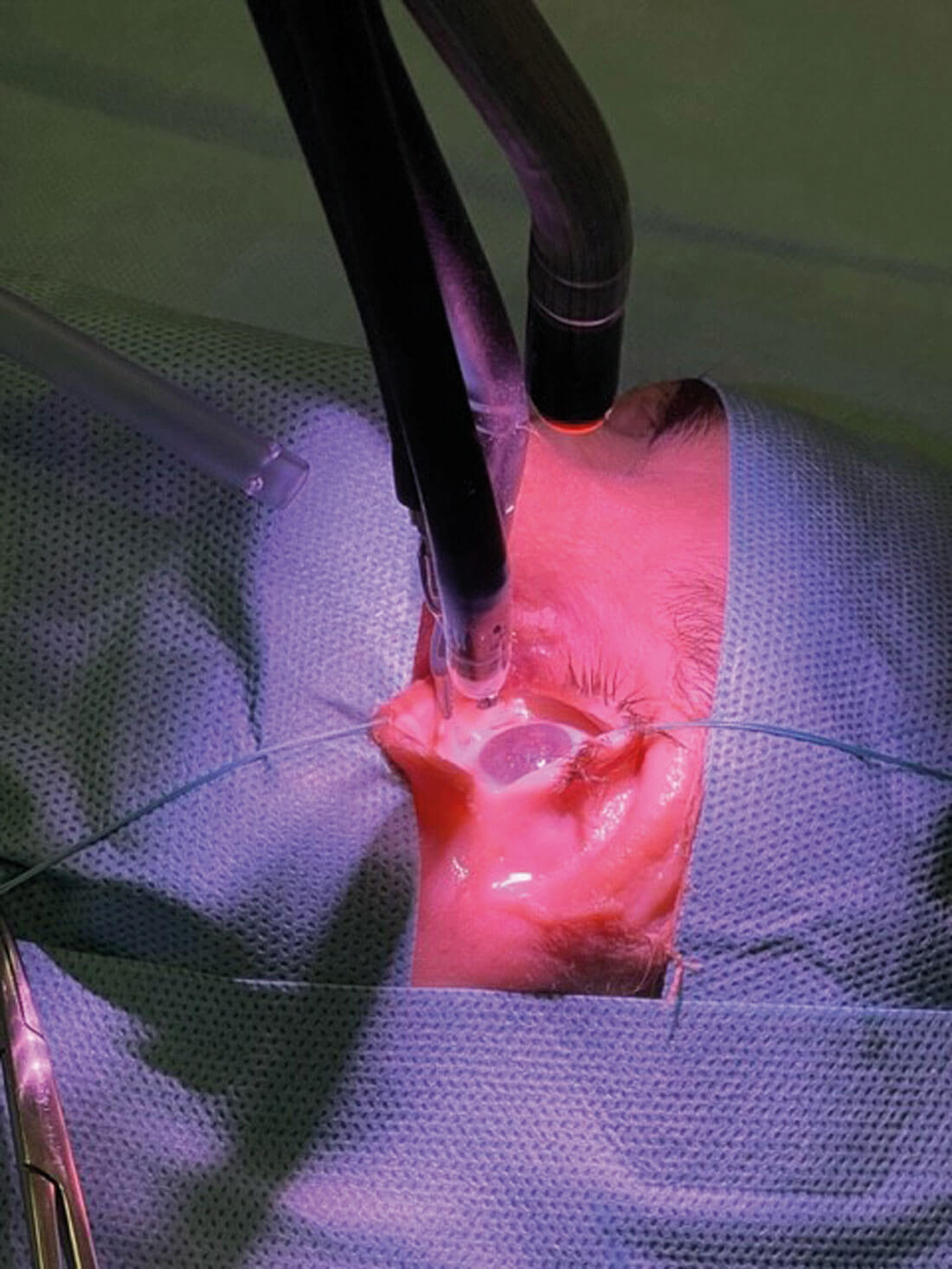 Image showing wet lab cadaveric experiments using da Vinci Single Port System to perform RAOS. 