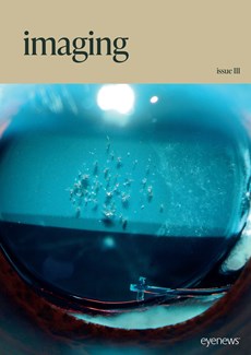 Imaging Issue III