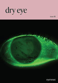 Dry Eye III