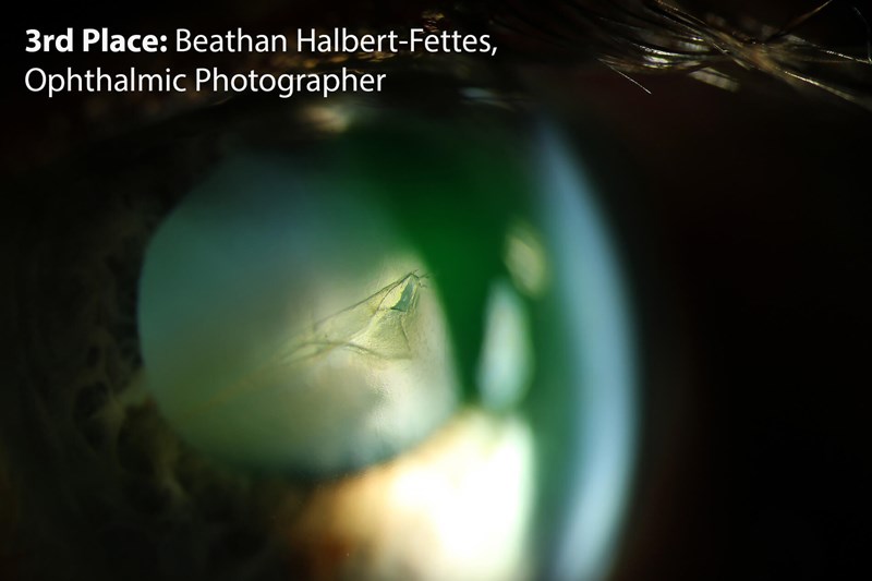 NEW-FOR-WEB-EYE-JUL25-ANTS-3rd---9.jpg