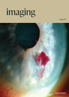 Imaging Issue IV