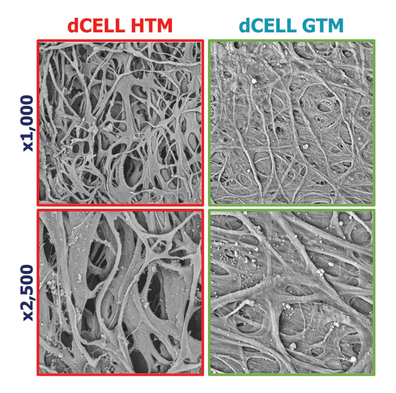 Image showing scanning electron microscope images of a decellularised TM (dTM) from a healthy (HTM) and glaucomatous eye (GTM).
