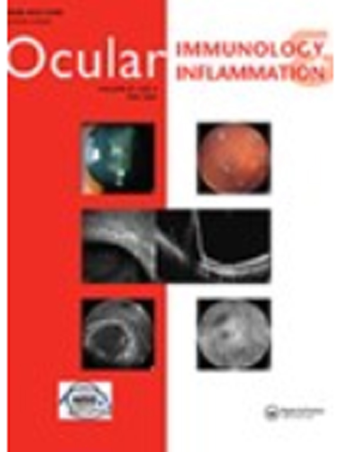 Ocular immunology and inflammation journal cover image.