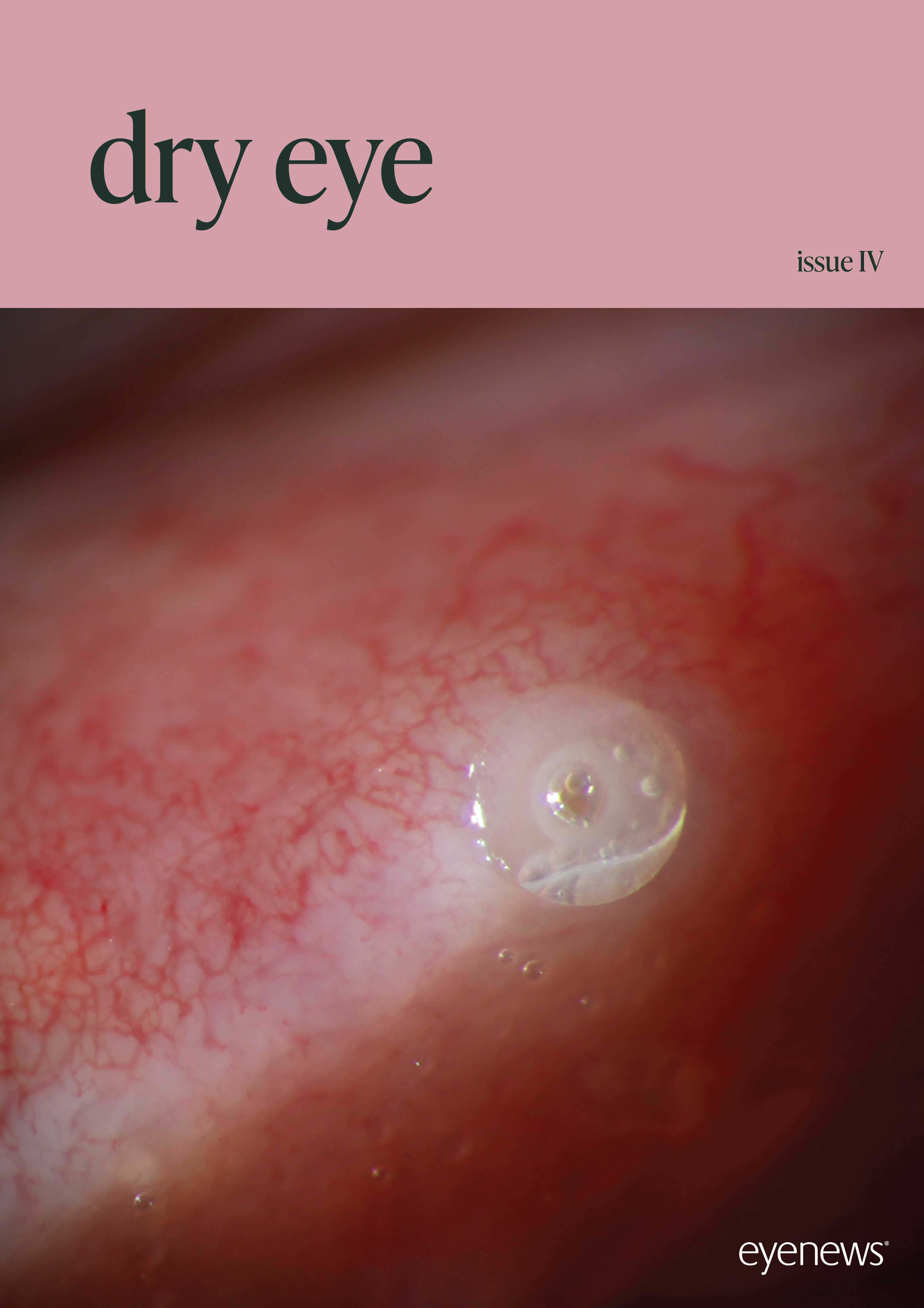 Dry Eye Issue IV