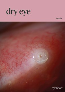 Dry Eye Issue IV