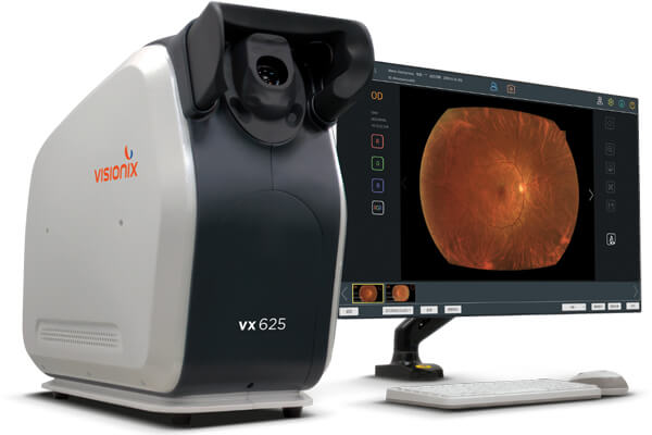 Visionix VX625 UWF 