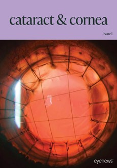 Cataract & Cornea Issue I