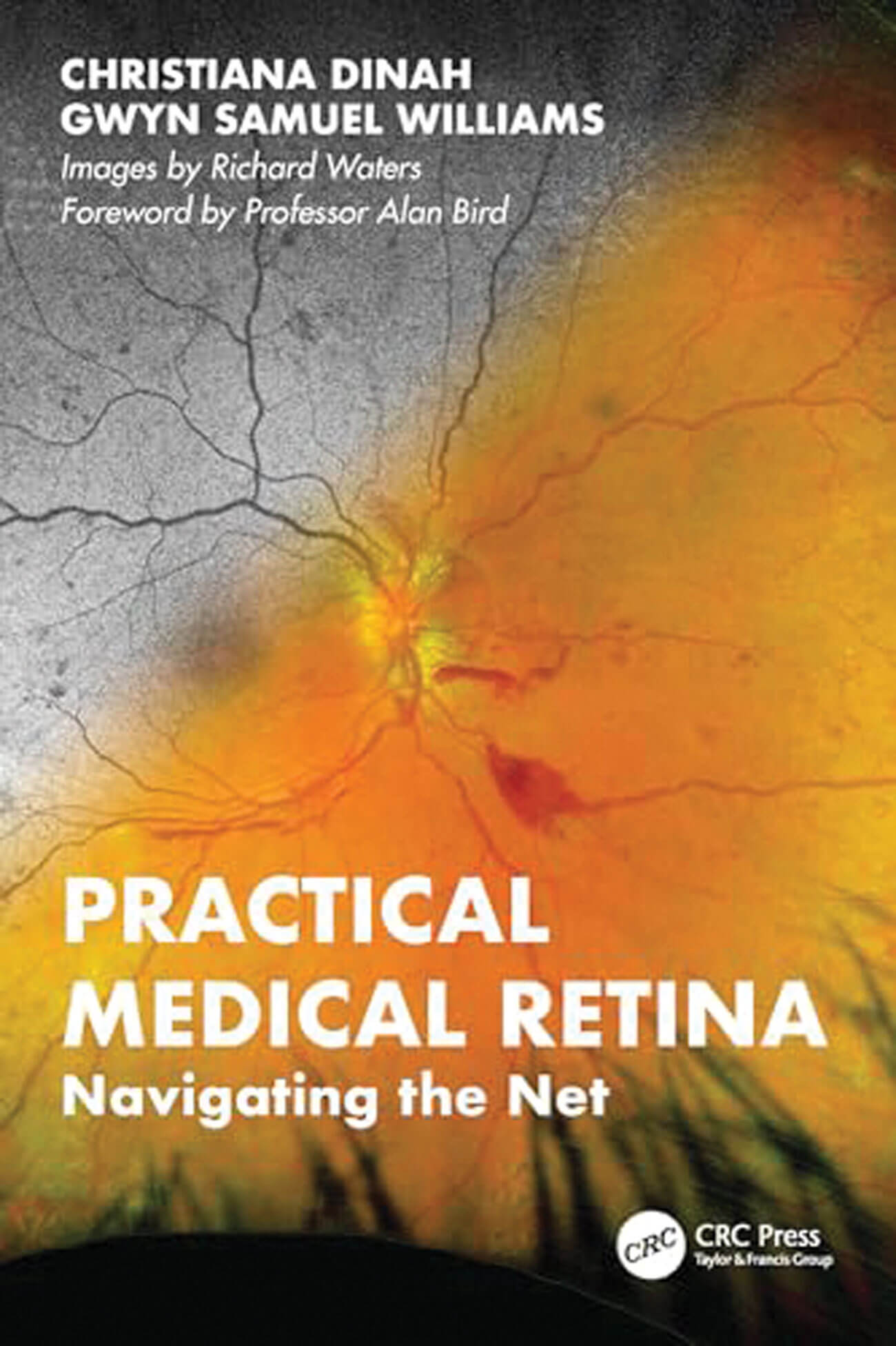 Practical Medical Retina book cover image.
