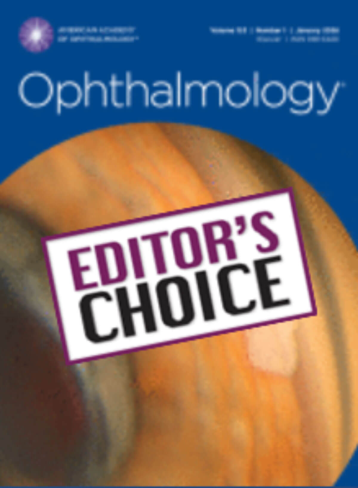 Ophthalmology journal cover image.