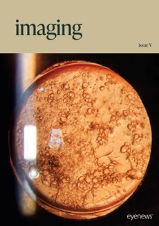 Imaging Issue V