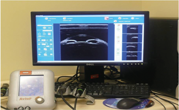 Biim Device The interpretation and use of ultrasound biomicroscopy (part 1) | Eye News